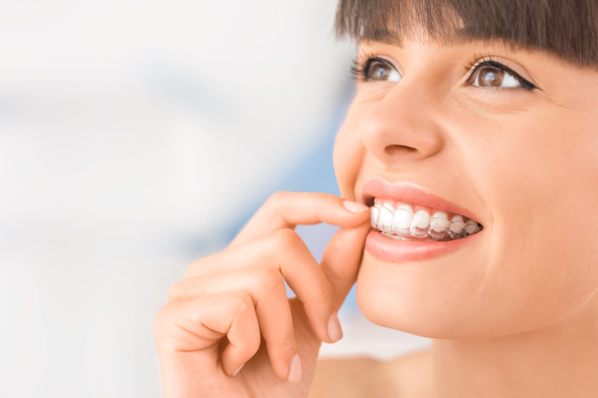 Invisalign: Why You Need to Make the Switch